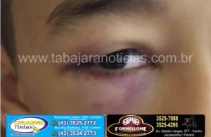 Garoto é agredido e fica ferido em trote na saída de escola em Marques dos reis